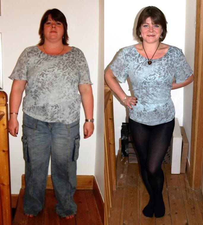 before and after weight. Dramatic efore and after